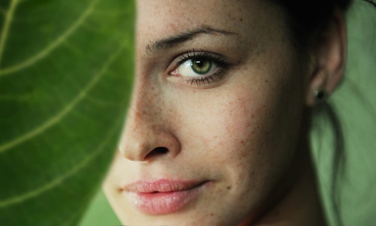 Melasma y manchas en la piel